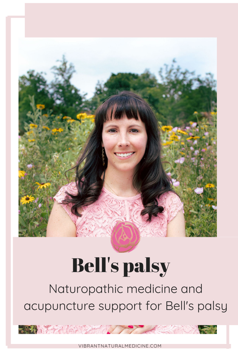 Bell's palsy acupuncture